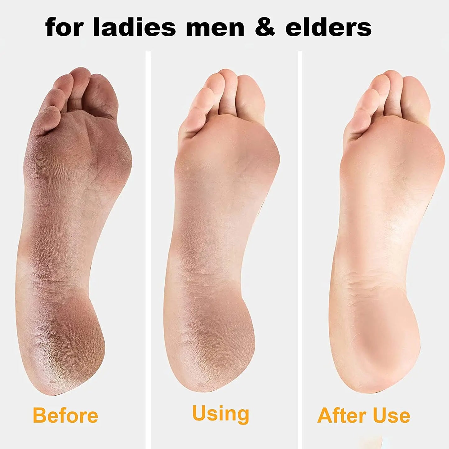 Pedicure Tools Heel Scratcher Files Artifact Exfoliating Calluses Brush Stainless Steel Foot Sharpening Double-sided Pedicura