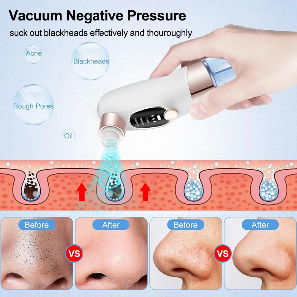 Blackhead Remover Electric BlackHead Extractor Pore Vacuum Cleaner Micro Small Bubble Acne Nose Deep Cleaning Black Head Remover