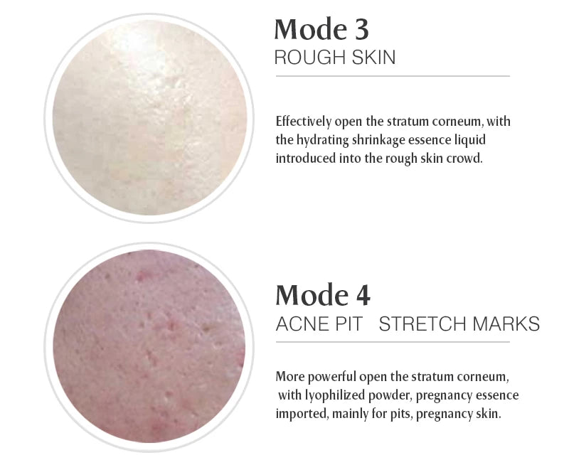 Professional High Frequency Beauty Instrument Skin Tightening Home Beauty Tools Wireless Rechargeable Multifunctional Skin Care