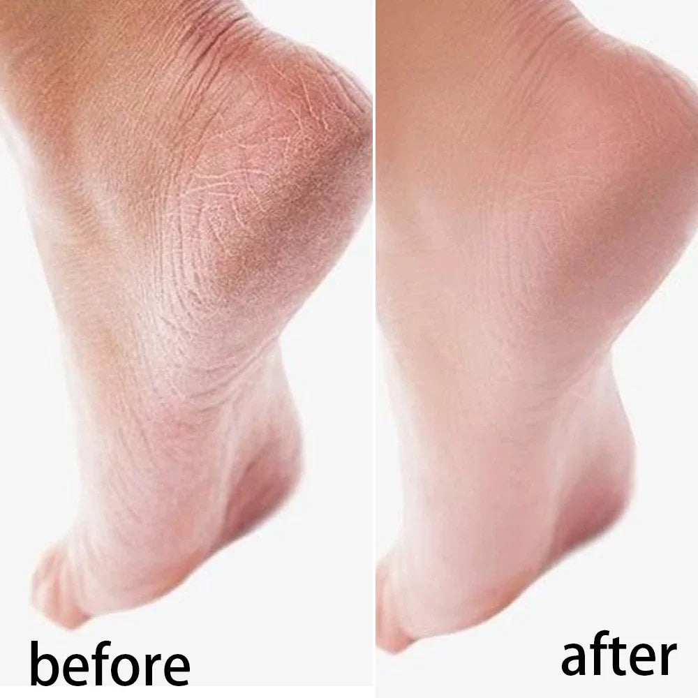 Reusable Moisturizing Mask Socks Exfoliating Anti Crack Silicone Protective Gloves Dry Dead Skin Remover Hand Foot Care Tools
