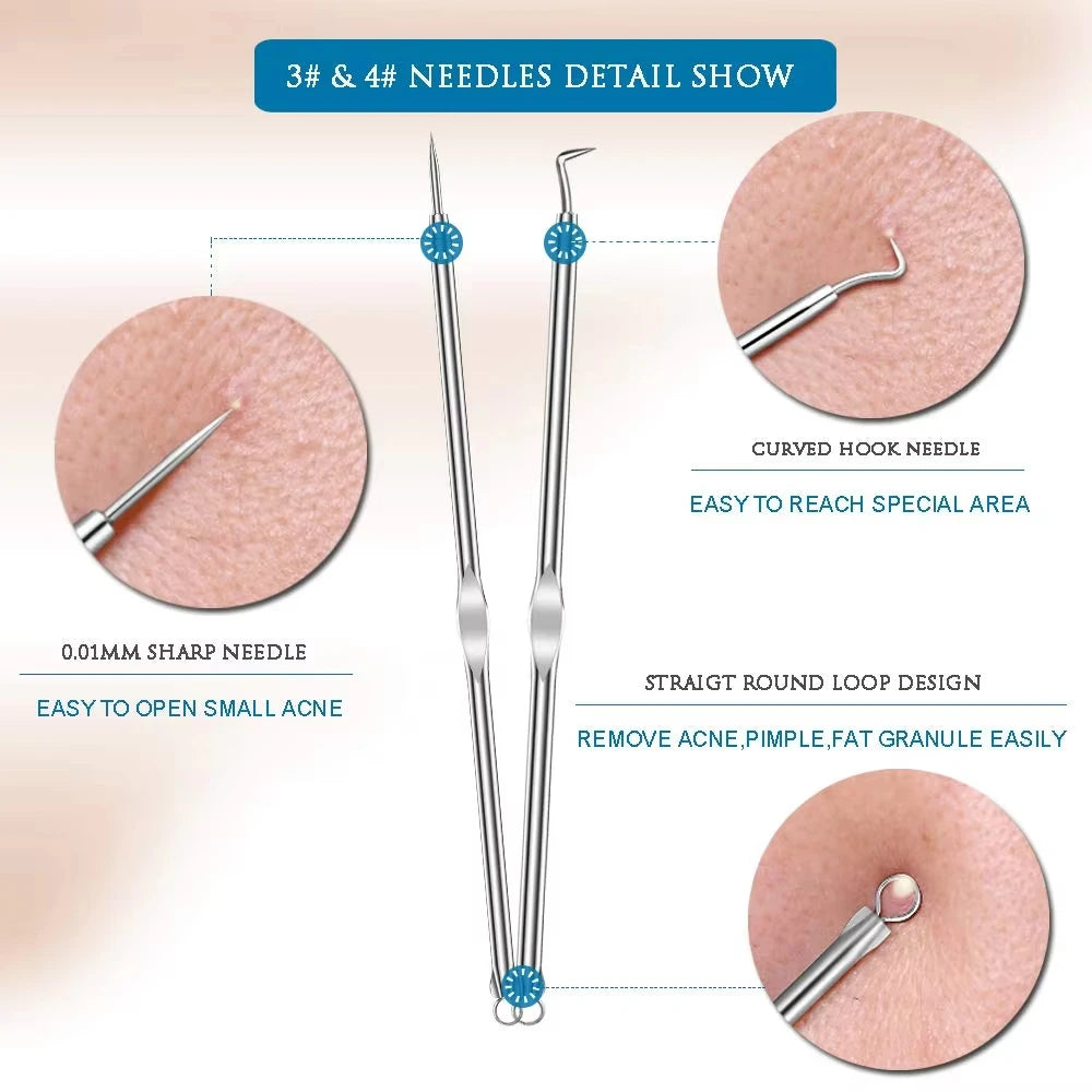 4Pcs Blackhead Remover Acne Needle Facial Cleansing Acne Extractor Remove Blackhead Pores Cleaning Tools