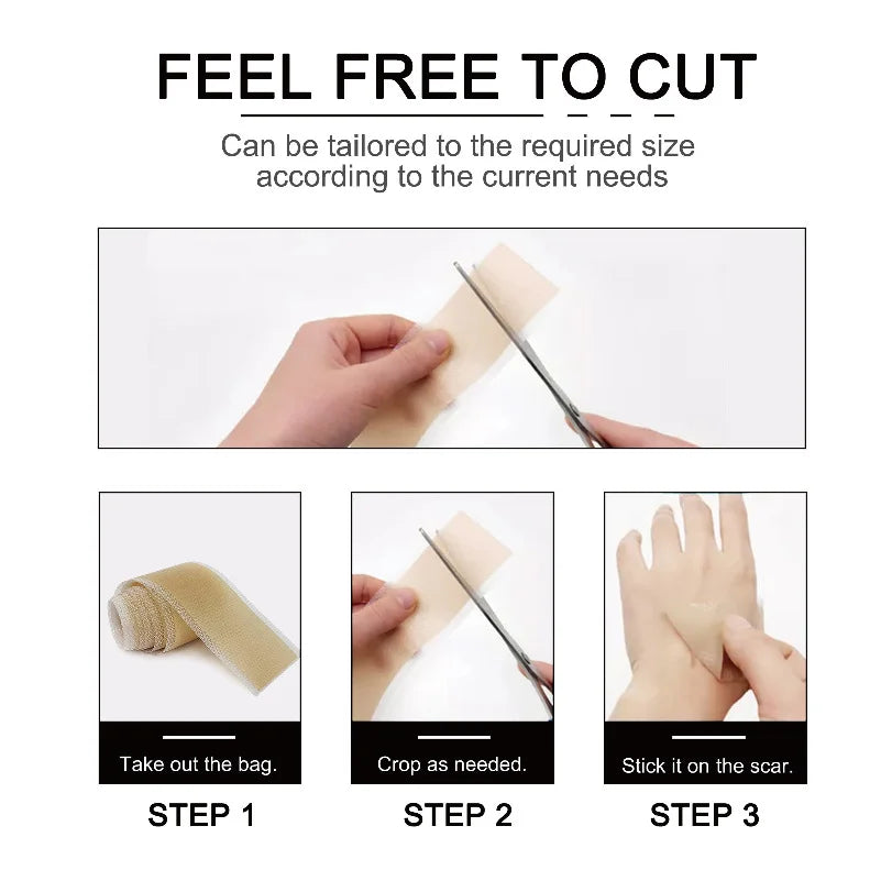 1 Roll = 4CM x 3M Silicone Scar Sheets Self-Adhesive Stretch Mark Tape Scar Cover Patch Reusable and Effective Skin Care Strips