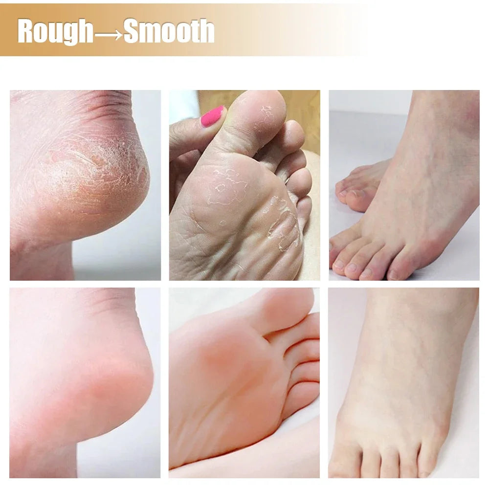 Reusable Moisturizing Mask Socks Exfoliating Anti Crack Silicone Protective Gloves Dry Dead Skin Remover Hand Foot Care Tools